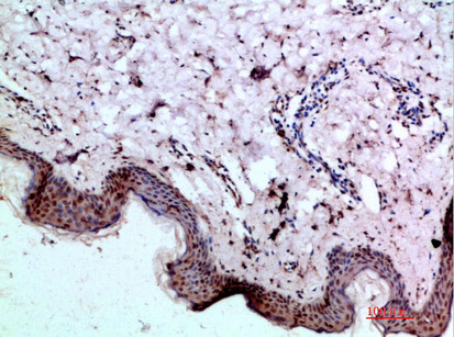 Immunohistochemical analysis of paraffin-embedded human-skin, antibody was diluted at 1:200