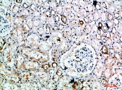 Immunohistochemical analysis of paraffin-embedded human-kidney, antibody was diluted at 1:200