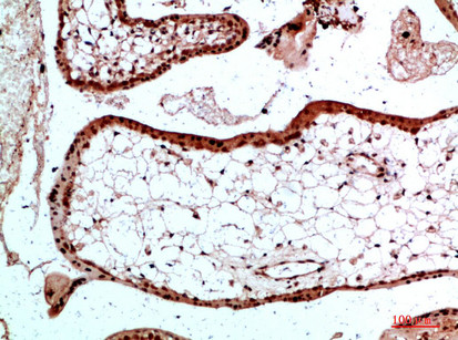 Immunohistochemical analysis of paraffin-embedded human-placenta, antibody was diluted at 1:200