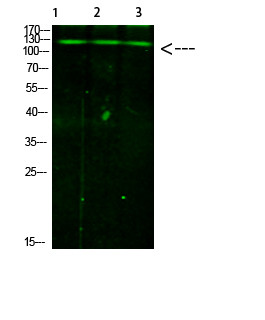 Immunofluorescence (IF): Western blot analysis of 1, mouse liver; 2, HeLa; 3, mouse brain cells using primary antibody STJ98830