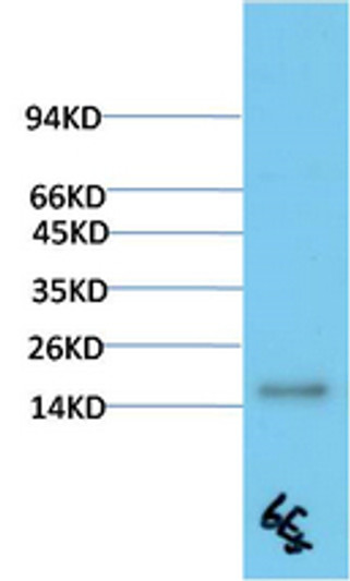 Western blot analysis of Human Serum using TTR Mouse mAb diluted at 1:2000 Western blot analysis of Human Serum using TTR Mouse mAb diluted at 1:2000