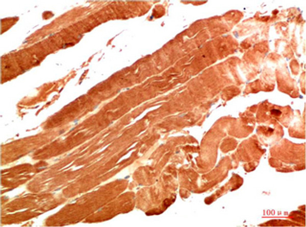 Immunohistochemical analysis of paraffin-embedded Human Skeletal Muscle Tissue using NBR1 Mouse mAb diluted at 1:200.