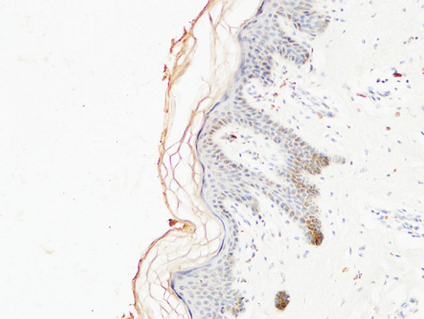Immunohistochemical analysis of paraffin-embedded Human skin. 1, Antibody was diluted at 1:200 (4°C overnight). 2, High-pressure and temperature EDTA, pH8.0 was used for antigen retrieval. 3, Secondary antibody was diluted at 1:200 (room temperature, 30min).