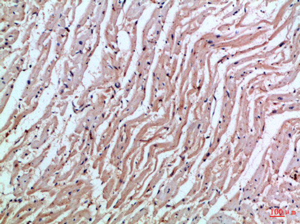 Immunohistochemical analysis of paraffin-embedded Human-heart, antibody was diluted at 1:100 Immunohistochemical analysis of paraffin-embedded Human-heart, antibody was diluted at 1:100