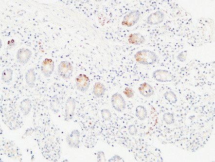 Immunohistochemical analysis of paraffin-embedded Human colon. 1, Antibody was diluted at 1:100 (4°C overnight). 2, High-pressure and temperature EDTA, pH8.0 was used for antigen retrieval. 3, Secondary antibody was diluted at 1:200 (room temperature, 30min).
