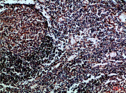 Immunohistochemical analysis of paraffin-embedded Human-tonsil, antibody was diluted at 1:100