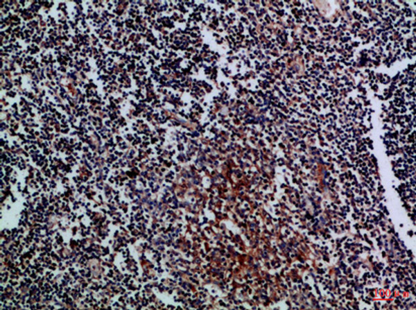 Immunohistochemical analysis of paraffin-embedded Human-tonsil, antibody was diluted at 1:100 Immunohistochemical analysis of paraffin-embedded Human-tonsil, antibody was diluted at 1:100