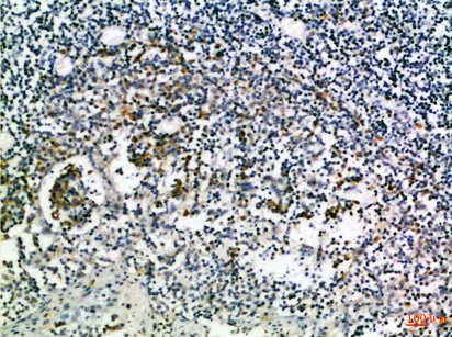 Immunohistochemical analysis of paraffin-embedded Human-tonsil, antibody was diluted at 1:100
