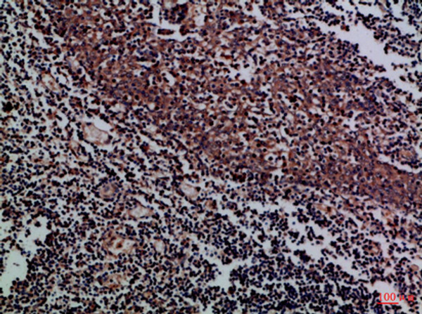 Immunohistochemical analysis of paraffin-embedded Human-tonsil, antibody was diluted at 1:100 Immunohistochemical analysis of paraffin-embedded Human-tonsil, antibody was diluted at 1:100