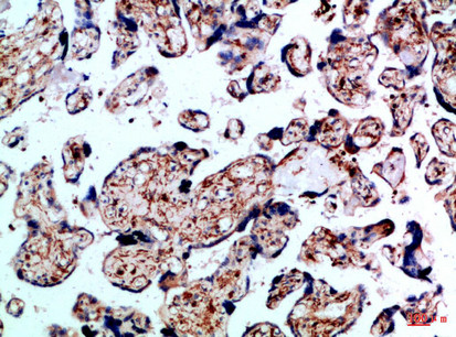 Immunohistochemical analysis of paraffin-embedded Human-placenta, antibody was diluted at 1:100