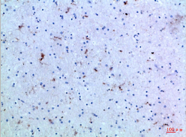 Immunohistochemical analysis of paraffin-embedded Human-brain, antibody was diluted at 1:100
