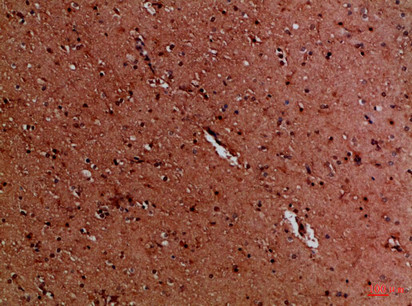 Immunohistochemical analysis of paraffin-embedded Human-brain, antibody was diluted at 1:100