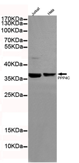Western blot detection of Protein Phosphatase 4C in HeLa and Jurkat cell lysates using Protein Phosphatase 4C mouse mAb STJ99049