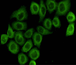 Immunocytochemistry staining of HeLa cells fixed with 4% Paraformaldehyde and using anti-pyruvate dehydrogenase (lipoamide) alpha 1 mouse mAb (dilution 1:100).