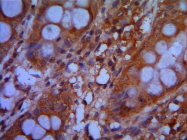 IHC of paraffin-embedded human colon using anti-CHD3 (C-terminus) diluted 1/500-1/1000. IHC of paraffin-embedded human colon using anti-CHD3 (C-terminus) diluted 1/500-1/1000.