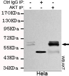Immunoprecipitation analysis of Hela cell lysates using AKT (pan) mouse mAb.