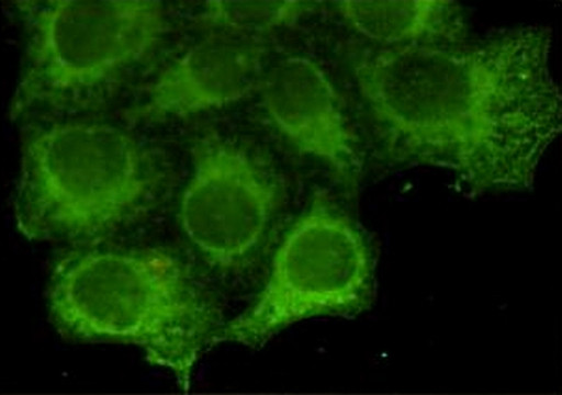 Immunocytochemistry staining of HeLa cells fixed by anhydrous methanol for 2 h at-20℃ and using anti-Keratin 18 mouse mAb (dilution 1:800).