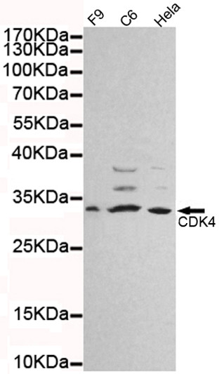 Western blot detection of CDK4 in Hela, C6 and F9 cell lysates using CDK4 mouse mAb (1:1000 diluted).Predicted band size:34KDa.Observed band size:34KDa. Western blot detection of CDK4 in Hela, C6 and F9 cell lysates using CDK4 mouse mAb (1:1000 diluted).Predicted band size:34KDa.Observed band size:34KDa.