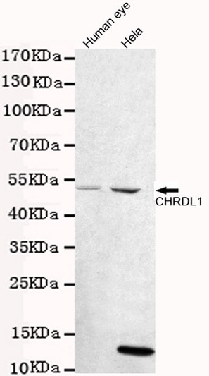 Western blot detection of CHRDL1 in human eye and HeLa cell lysates using CHRDL1 mouse mAb (1:1000 diluted). Predicted STJ99125