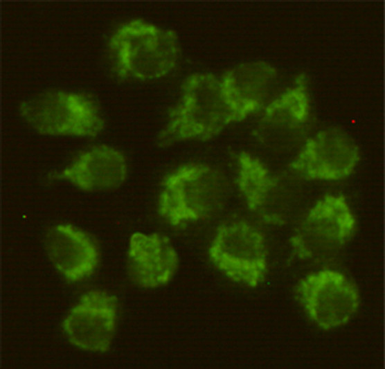 Immunocytochemistry staining of HeLa cells fixed with-20℃ Methanol and using Fyn mouse mAb (dilution 1:50). Immunocytochemistry staining of HeLa cells fixed with-20℃ Methanol and using Fyn mouse mAb (dilution 1:50).
