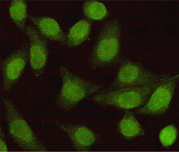 Immunocytochemistry staining of HeLa cells fixed with 1% Paraformaldehyde and using Smad2 mouse mAb (dilution 1:100).