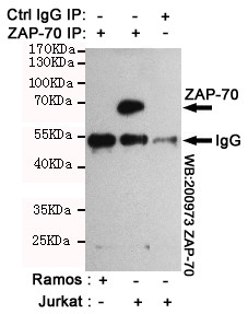 Immunoprecipitation analysis of Jurkat cell lysates (ZAP-70 positive expression cell line) and Ramos cell lysates (ZAP-70 negative expression cell line) using ZAP-70 mouse mAb.