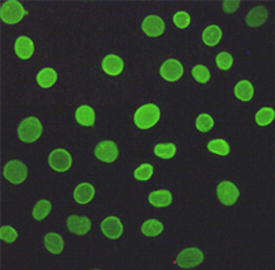 Immunofluorescent analysis of A549 cells fixed with 4% Paraformaldehyde and using anti-Lamin A/C mouse mAb (dilution 1:200).