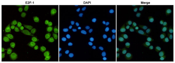 Immunofluorescent analysis of Hela cells fixed with 4% Paraformaldehyde and using anti-E2F-1 mouse mAb (dilution 1:100). DAPI was used to stain nucleus (blue). Immunofluorescent analysis of Hela cells fixed with 4% Paraformaldehyde and using anti-E2F-1 mouse mAb (dilution 1:100). DAPI was used to stain nucleus (blue).