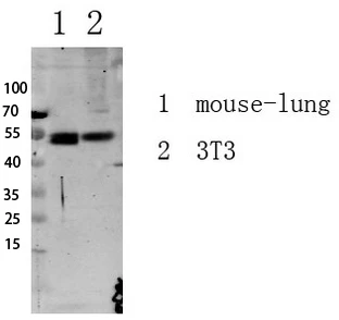 Western blot analysis of various lysates. Antibody was diluted at 1:1000. Secondary antibody was STJ99595