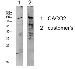 Western blot analysis of various lysates. Antibody was diluted at 1:1000. Secondary antibody was STJ99614