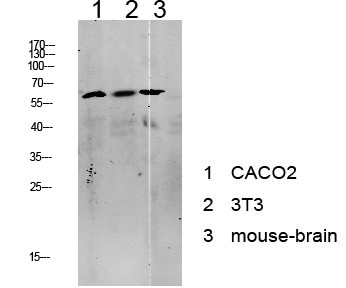 Western blot analysis of various lysates, antibody was diluted at 1:1000. Secondary antibody was STJ99631