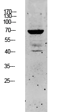 Western blot analysis of SW480 lysate, antibody was diluted at 1:1000. Secondary antibody was STJ99636