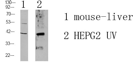 Western blot analysis of various lysates. Antibody was diluted at 1:1000. Secondary antibody was STJ99648