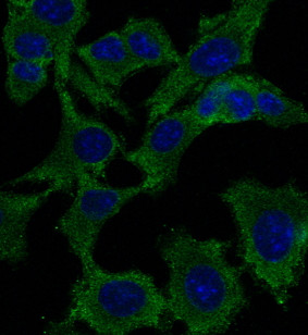 Anti TP53 Goat Polyclonal antibody immunofluorescence STJ140114