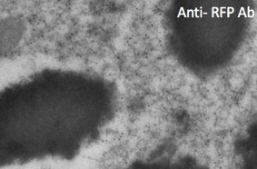 Anti RFP Goat Polyclonal antibody immunoelectron microscopy STJ140119