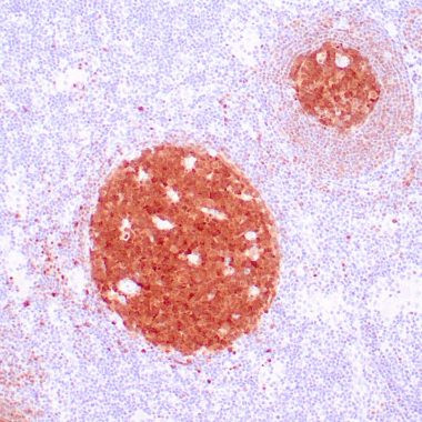 Anti-BOB1 antibody IHC Human lymph node STJ180315
