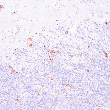 Anti-Factor VIII-R antibody IHC Human tonsil STJ180322