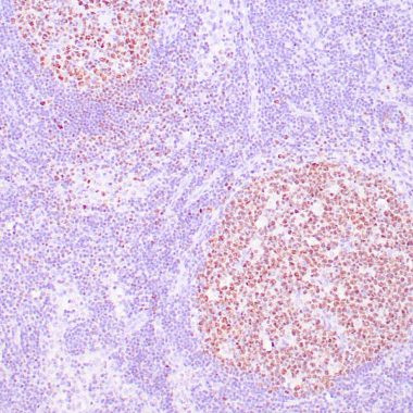 Anti-OCT-2 antibody IHC Human lymph node STJ180327