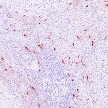 Anti-Tryptase antibody IHC Human tonsil STJ180331