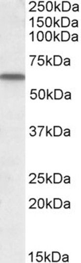 STJ71299 (1µg/ml) staining of Human Lung lysate (35µg protein in RIPA buffer). Primary incubation was 1 hour. Detected by chemiluminescence.