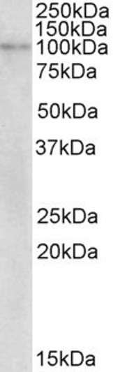 STJ72177 (2µg/ml) staining of Human Breast cancer lysate (35µg protein in RIPA buffer). Primary incubation was 1 hour. Detected by chemiluminescence.