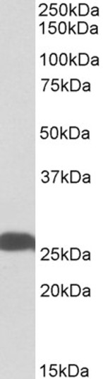 STJ72312 (0. 01µg/ml) staining of Human Hippocampus lysate (35µg protein in RIPA buffer). Primary incubation was 1 hour. Detected by chemiluminescence.