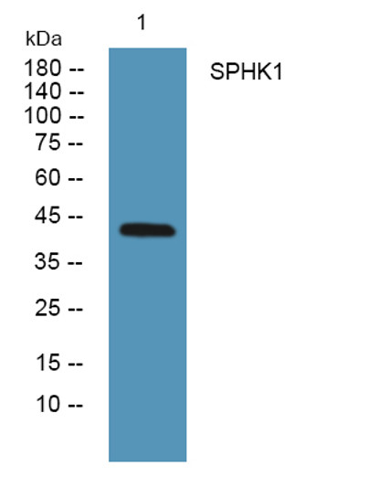 Western blot analysis of lysates from HCT116 cells, primary antibody was diluted at 1:1000, 4°C over night