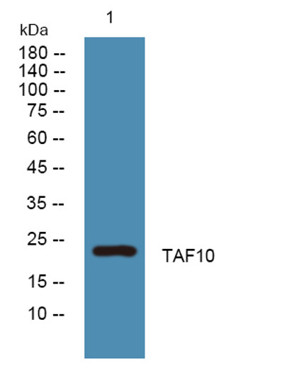 Western blot analysis of lysates from SW480 cells, primary antibody was diluted at 1:1000, 4°C over night