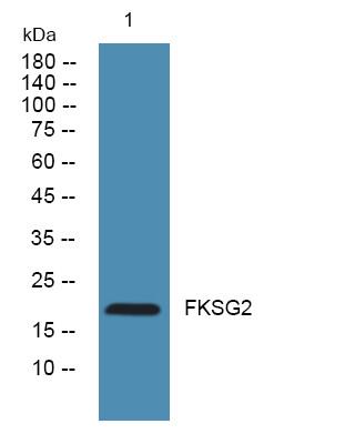 Western blot analysis of lysates from HCT116 cells, primary antibody was diluted at 1:1000, 4°C over night