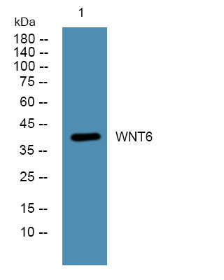 Western blot analysis of lysates from KB cells, primary antibody was diluted at 1:1000, 4°C over night