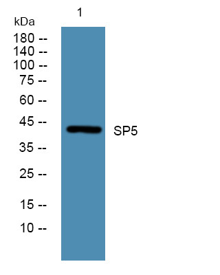 Western blot analysis of lysates from PC12 cells, primary antibody was diluted at 1:1000, 4°C over night