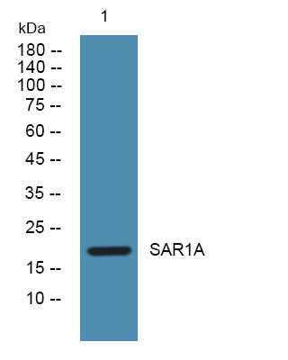 Western blot analysis of lysates from K562 cells, primary antibody was diluted at 1:1000, 4°C over night