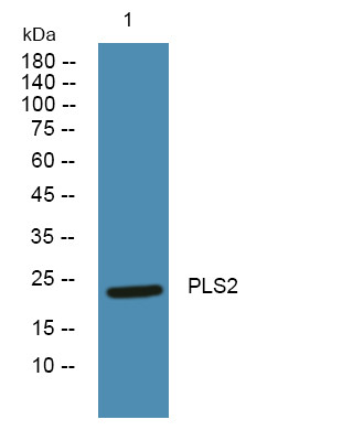 Western blot analysis of lysates from PC12 cells, primary antibody was diluted at 1:1000, 4°C over night