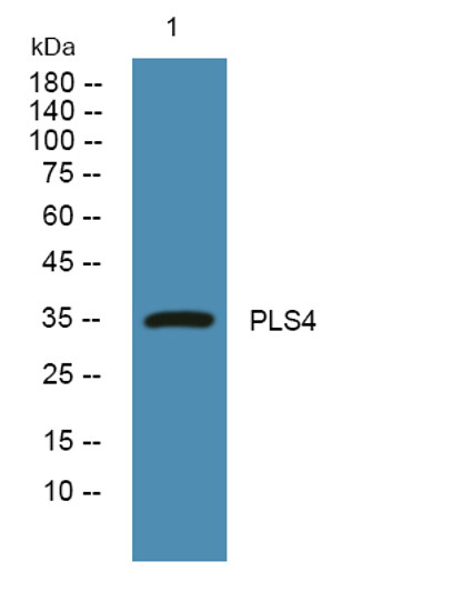 Western blot analysis of lysates from PC12 cells, primary antibody was diluted at 1:1000, 4°C over night